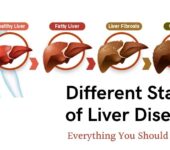 Liva 07 & Heptovit – For Your Liver Health Support