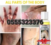 Extra Strong Whitening Peeling Oil