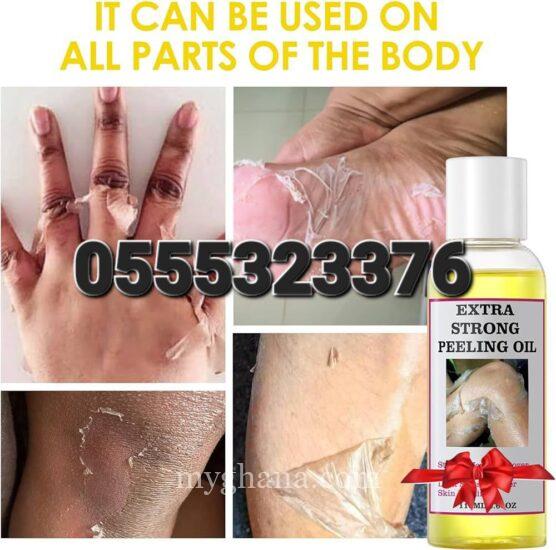 Extra Strong Whitening Peeling Oil