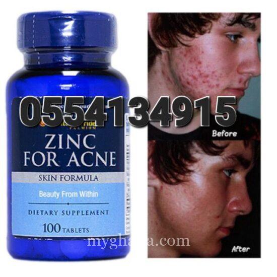 Puritan’s Pride Zinc For Acne